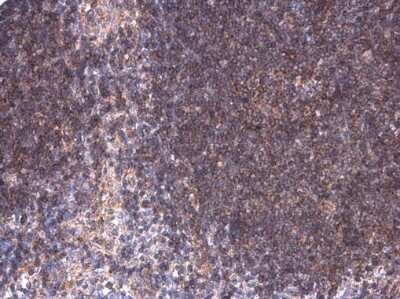 Immunohistochemistry-Paraffin: BTK [p Tyr223] Antibody [NBP3-12916]